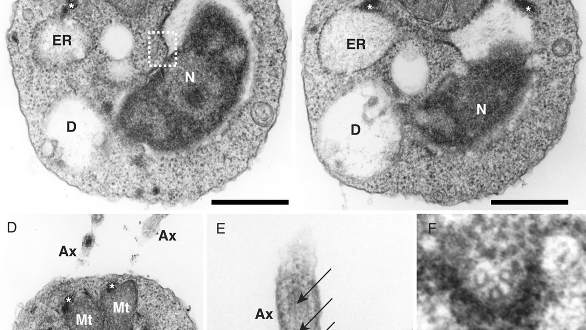 Electron micrograph of mitochondria — the cellular furnaces where glucagon-driven energy expenditure is spent; a Panatrutide feature by Panacea Bio Chem and Bogdan Dicoias